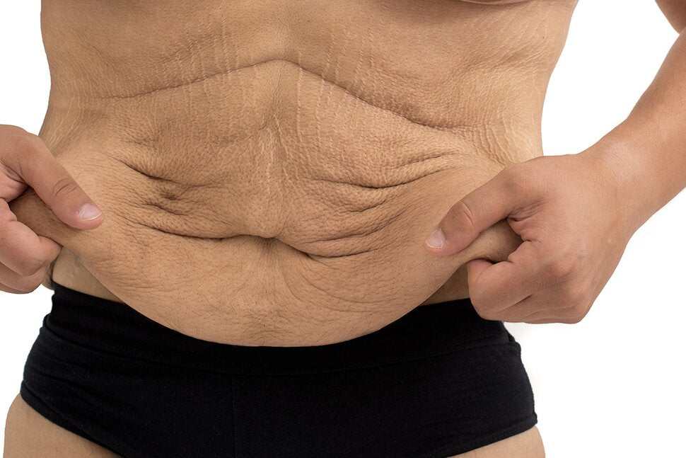 Can Your Diet Help Tighten Your Skin When You Lose Weight?