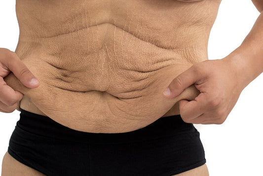 Can Your Diet Help Tighten Your Skin When You Lose Weight?